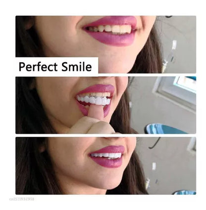 Carillas Dentales: La Solución Perfecta para una Sonrisa Impecable