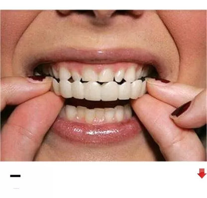 Carillas Dentales: La Solución Perfecta para una Sonrisa Impecable